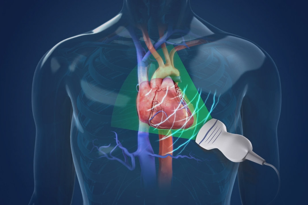 Nieuwe vooruitgang in interventionele echografie